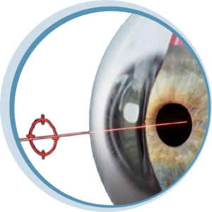 OVITZ Precise Correction on the Accurate Axis